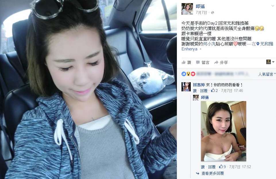 隆乳,水滴果凍矽膠隆乳,邱逼