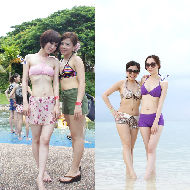 隆乳C罩杯,隆乳,QQ果凍矽膠隆乳,V妞,水滴型果凍矽膠隆乳