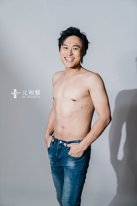 男性女乳價錢,男性女乳ptt,男性女乳費用,男性女乳缺點, 男性女乳Dcard,男性女乳術後,男性女乳失敗,男性女乳手術術後恢復期心得日記男性女乳經驗分享,男性女乳費用,男性女乳手術