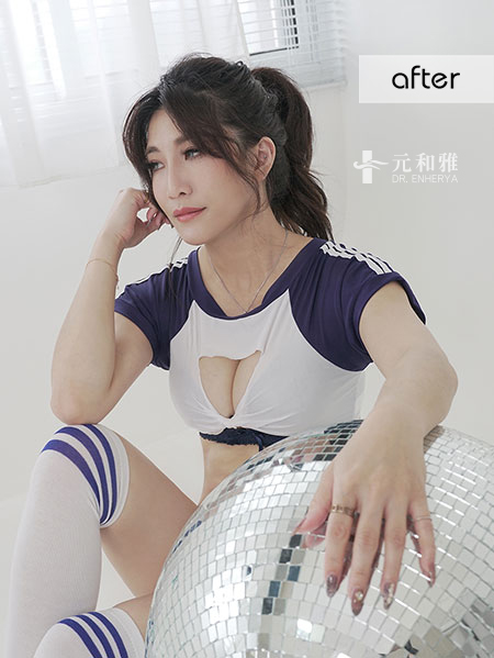 魔滴隆乳缺點,魔滴Dcard,魔滴隆乳術後,魔滴隆乳失敗,魔滴隆乳手術術後恢復期心得日記魔滴隆乳經驗分享 ,魔滴隆乳費用價格,魔滴隆乳推薦,魔滴隆乳,motiva 魔滴隆乳缺點,魔滴Dcard,魔滴隆乳術後,魔滴隆乳失敗,魔滴隆乳手術術後恢復期心得日記魔滴隆乳經驗分享 ,魔滴隆乳費用價格,魔滴隆乳推薦,魔滴隆乳,motiva