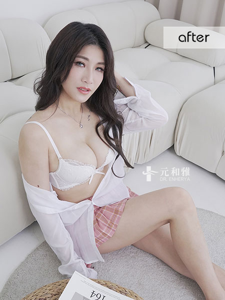 魔滴隆乳缺點,魔滴Dcard,魔滴隆乳術後,魔滴隆乳失敗,魔滴隆乳手術術後恢復期心得日記魔滴隆乳經驗分享 ,魔滴隆乳費用價格,魔滴隆乳推薦,魔滴隆乳,motiva 魔滴隆乳缺點,魔滴Dcard,魔滴隆乳術後,魔滴隆乳失敗,魔滴隆乳手術術後恢復期心得日記魔滴隆乳經驗分享 ,魔滴隆乳費用價格,魔滴隆乳推薦,魔滴隆乳,motiva