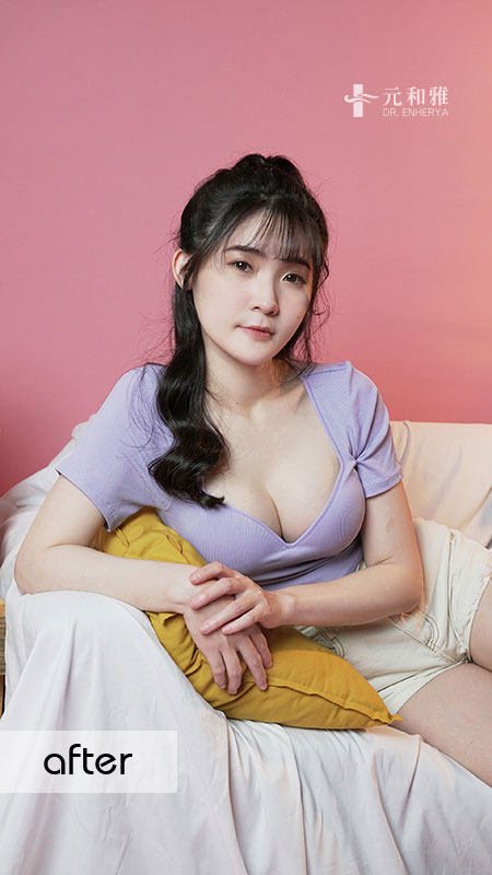 女王波隆乳價錢,女王波隆乳ptt,女王波隆乳費用,女王波隆乳缺點, 女王波隆乳Dcard,女王波隆乳術後,女王波隆乳失敗,女王波隆乳手術術後恢復期心得日記女王波隆乳經驗分享,女王波隆乳費用,女王波隆乳手術,女王波隆乳後悔,女王波隆乳失敗