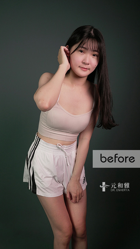 女王波隆乳價錢,女王波隆乳ptt,女王波隆乳費用,女王波隆乳缺點, 女王波隆乳Dcard,女王波隆乳術後,女王波隆乳失敗,女王波隆乳手術術後恢復期心得日記女王波隆乳經驗分享,女王波隆乳費用,女王波隆乳手術,女王波隆乳後悔,女王波隆乳失敗