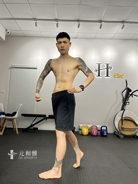 平胸價錢,平胸ptt,平胸費用,平胸缺點, 平胸Dcard,平胸術後,平胸失敗,平胸手術術後恢復期心得日記平胸經驗分享,平胸費用,平胸手術,平胸後悔,平胸失敗,平胸案例,平胸Dcard,平胸材質,平胸價格,2023平胸懶人包,平胸方式比較,平胸手術切口,平胸適合對象,平胸手術醫師選擇 平胸價錢,平胸ptt,平胸費用,平胸缺點, 平胸Dcard,平胸術後,平胸失敗,平胸手術術後恢復期心得日記平胸經驗分享,平胸費用,平胸手術,平胸後悔,平胸失敗,平胸案例,平胸Dcard,平胸材質,平胸價格,2023平胸懶人包,平胸方式比較,平胸手術切口,平胸適合對象,平胸手術醫師選擇