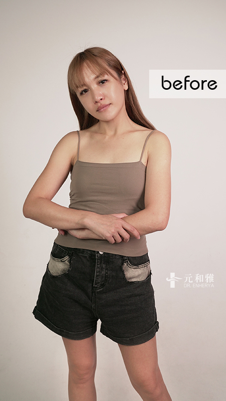 女王波隆乳價錢,女王波隆乳ptt,女王波隆乳費用,女王波隆乳缺點, 女王波隆乳Dcard,女王波隆乳術後,女王波隆乳失敗,女王波隆乳手術術後恢復期心得日記女王波隆乳經驗分享,女王波隆乳費用,女王波隆乳手術,女王波隆乳後悔,女王波隆乳失敗,女王波隆乳案例,女王波隆乳Dcard,女王波隆乳材質,女王波隆乳價格,2022女王波隆乳懶人包,女王波隆乳方式比較,女王波隆乳手術切口,女王波隆乳適合對象,女王波隆乳手術醫師選擇 女王波隆乳價錢,女王波隆乳ptt,女王波隆乳費用,女王波隆乳缺點, 女王波隆乳Dcard,女王波隆乳術後,女王波隆乳失敗,女王波隆乳手術術後恢復期心得日記女王波隆乳經驗分享,女王波隆乳費用,女王波隆乳手術,女王波隆乳後悔,女王波隆乳失敗,女王波隆乳案例,女王波隆乳Dcard,女王波隆乳材質,女王波隆乳價格,2022女王波隆乳懶人包,女王波隆乳方式比較,女王波隆乳手術切口,女王波隆乳適合對象,女王波隆乳手術醫師選擇