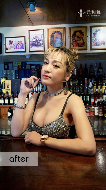 女王波隆乳價錢,女王波隆乳ptt,女王波隆乳費用,女王波隆乳缺點, 女王波隆乳Dcard,女王波隆乳術後,女王波隆乳失敗,女王波隆乳手術術後恢復期心得日記女王波隆乳經驗分享,女王波隆乳費用,女王波隆乳手術,女王波隆乳後悔,女王波隆乳失敗,女王波隆乳案例,女王波隆乳Dcard,女王波隆乳材質,女王波隆乳價格,2022女王波隆乳懶人包,女王波隆乳方式比較,女王波隆乳手術切口,女王波隆乳適合對象,女王波隆乳手術醫師選擇 女王波隆乳價錢,女王波隆乳ptt,女王波隆乳費用,女王波隆乳缺點, 女王波隆乳Dcard,女王波隆乳術後,女王波隆乳失敗,女王波隆乳手術術後恢復期心得日記女王波隆乳經驗分享,女王波隆乳費用,女王波隆乳手術,女王波隆乳後悔,女王波隆乳失敗,女王波隆乳案例,女王波隆乳Dcard,女王波隆乳材質,女王波隆乳價格,2022女王波隆乳懶人包,女王波隆乳方式比較,女王波隆乳手術切口,女王波隆乳適合對象,女王波隆乳手術醫師選擇