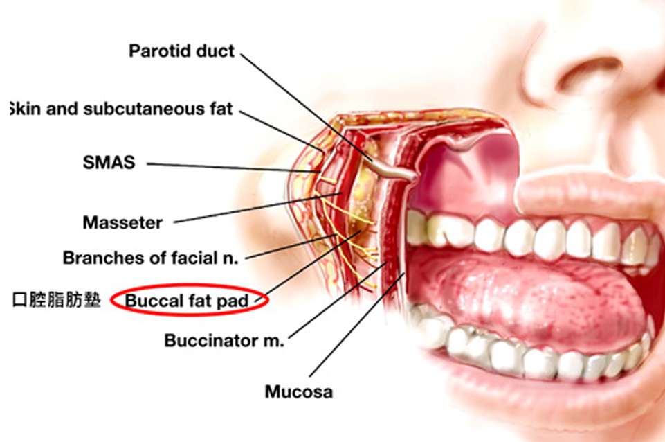 口內脂肪墊位置