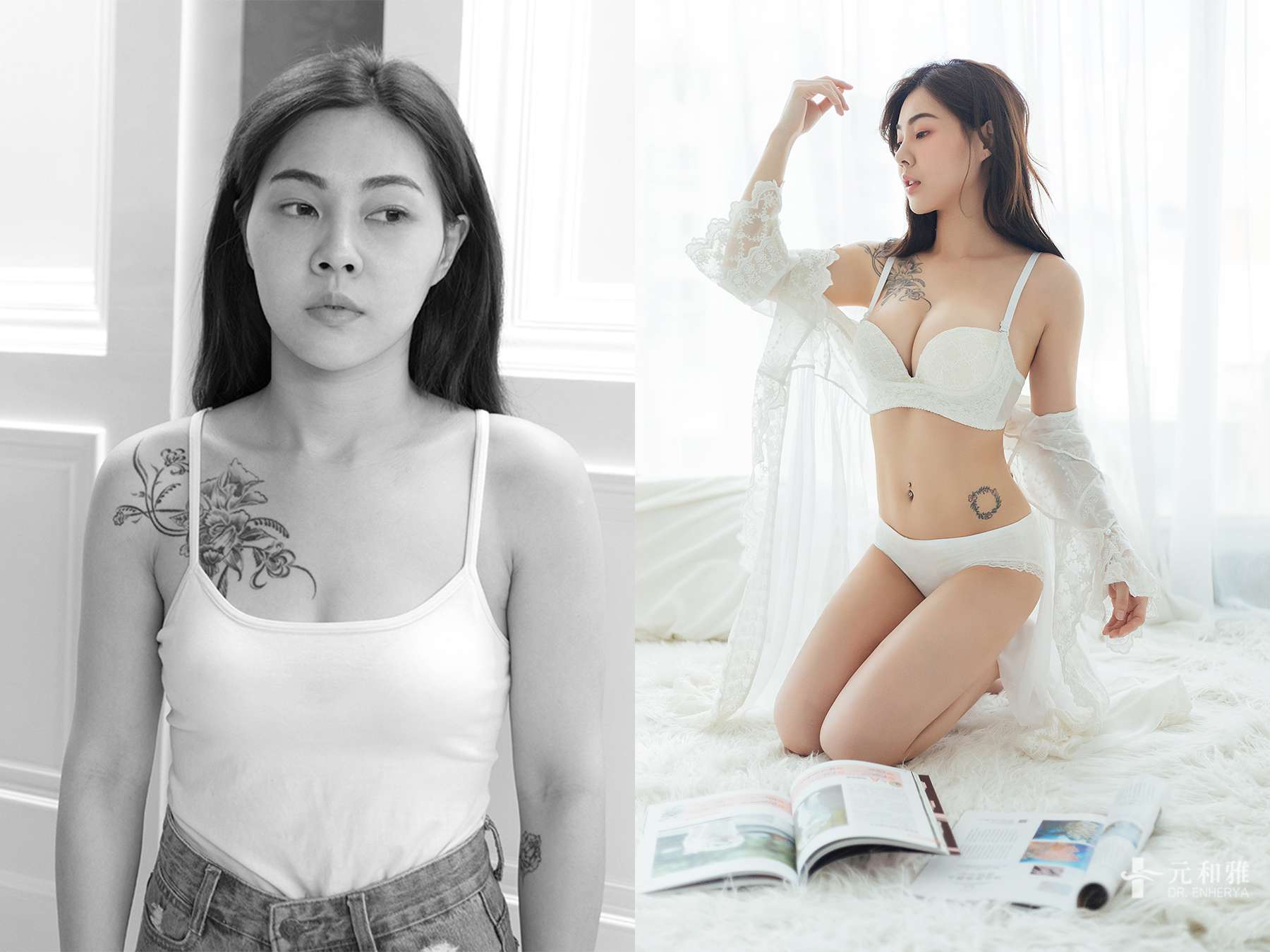 2024自體脂肪隆乳助正妹薇薇展現火辣胴體體態大躍級  2024高雄台南台北自體脂肪隆乳