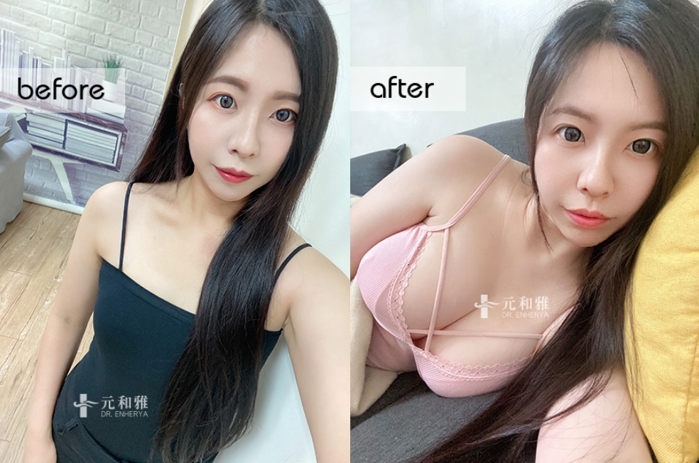 JOY魔滴2.0幫甜美女孩加辣！圓潤酥胸融化眾人目光